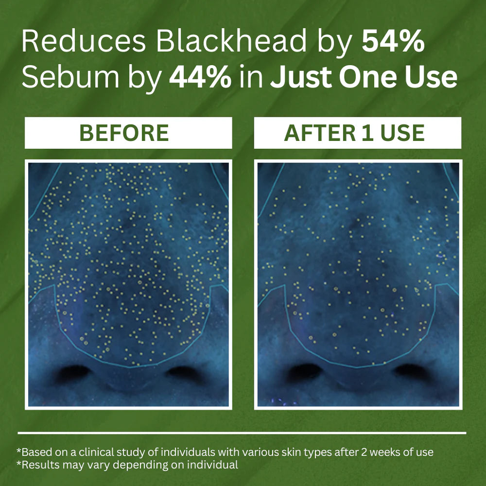 Holy Basil Sparkling Bubble Mask