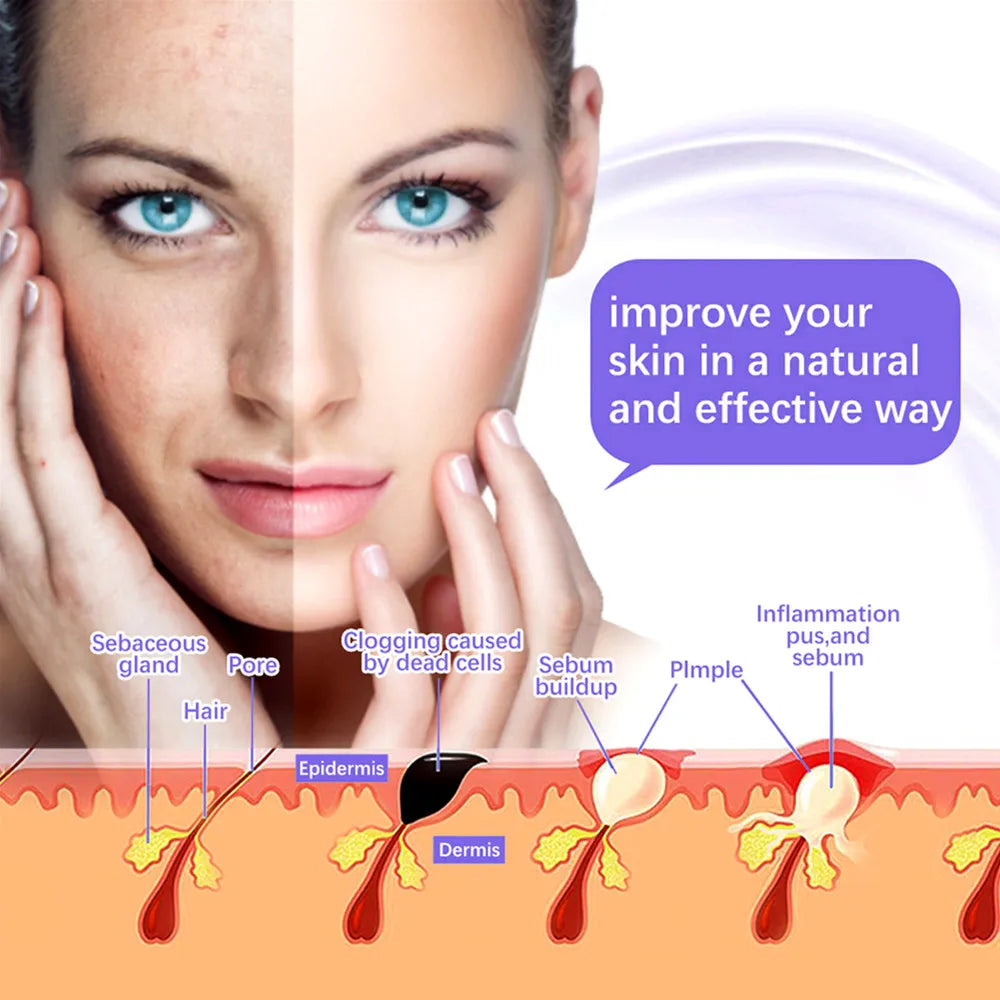 GlowPulse High Frequency Facial Renewal Wand